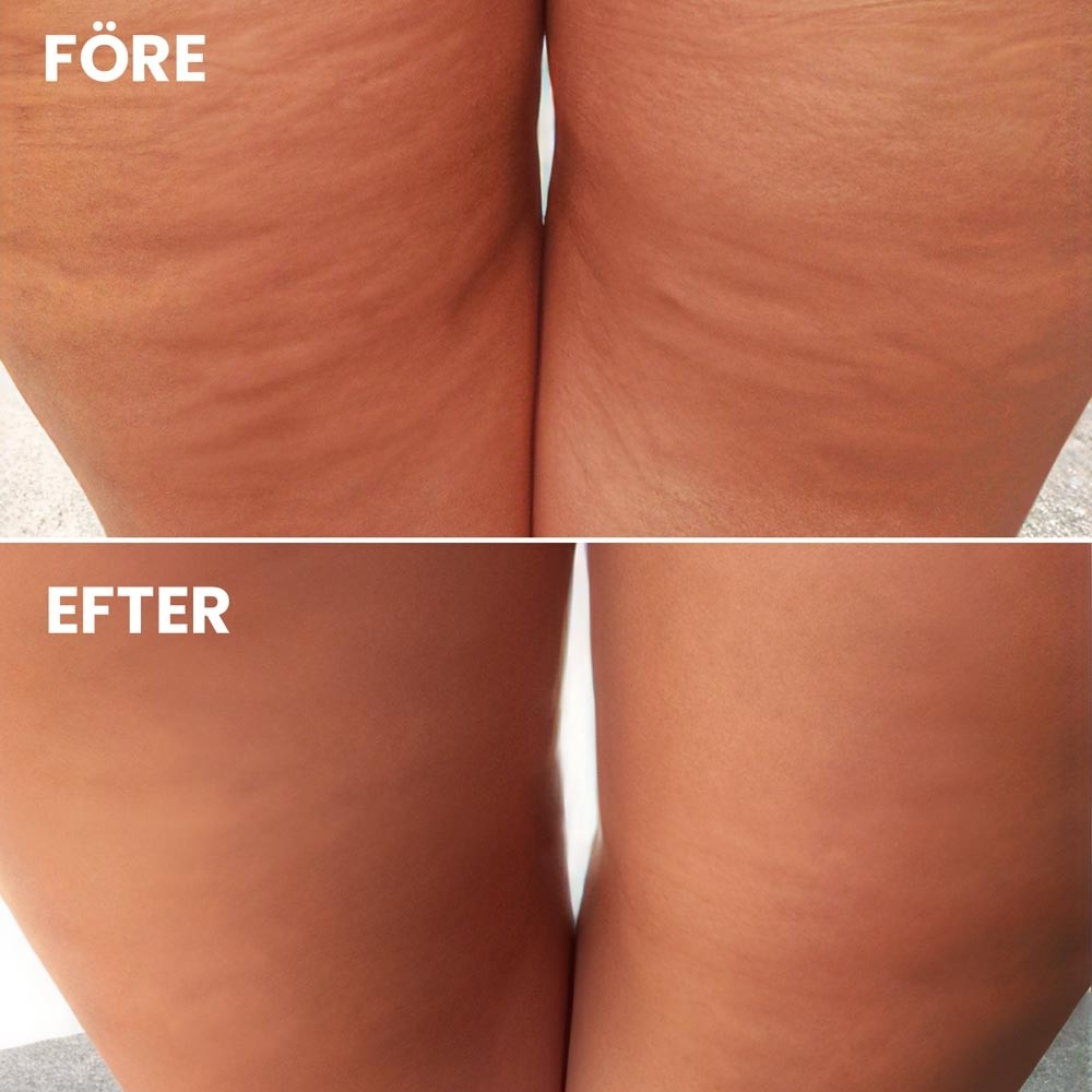 before-after-2