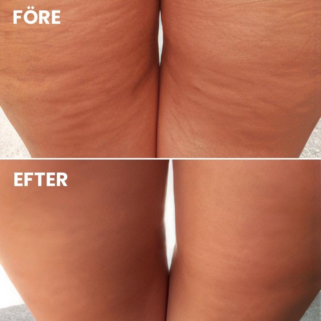 before-after-2