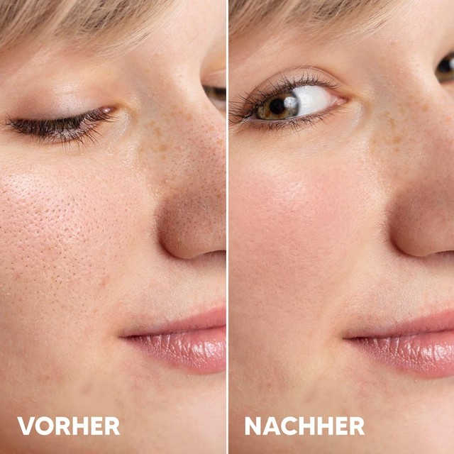 AHA-SERUM----5---PRIJE---POSLIJE-de