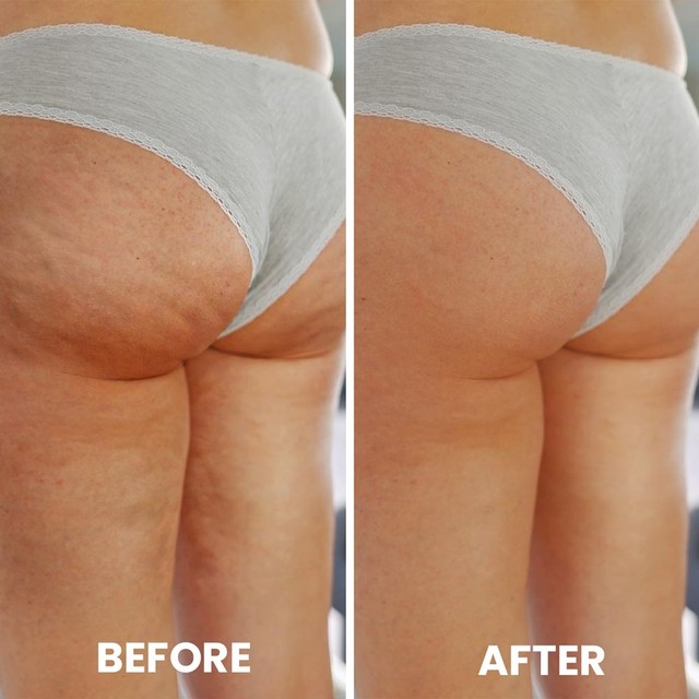 before-after---slajd---topform-ENG